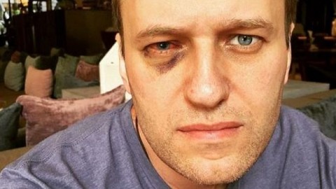 Putin critic Navalny has eye surgery in Spain after attack