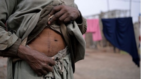 Pakistan’s illegal kidney trade propped up by both poor and wealthy