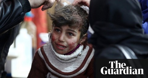Hala, 9, receives treatment at a makeshift hospital in besieged eastern Ghouta. Photo: Amer Almohibany/AFP/Getty Images