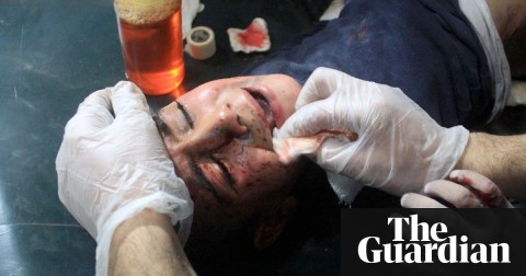  A wounded Syrian child receives medical treatment after being hit in an airstrike by the Assad regime on a residential area of eastern Ghouta. Photo: Anadolu Agency/Getty Images