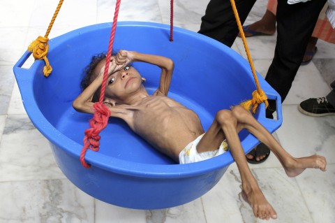 葉門持續內戰，超過500萬兒童面臨飢荒